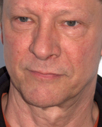 1812730_2870_profile