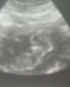 223143_45735_profile